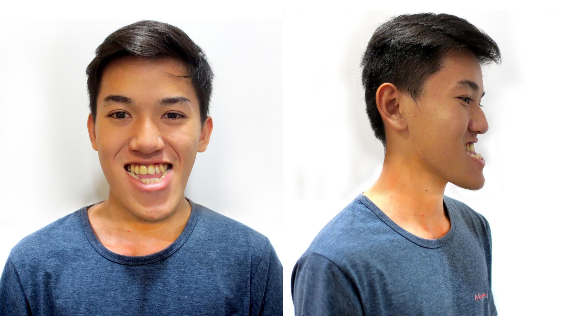 Bệnh viện thẩm mỹ JW ảnh 1 Benh vien tham my JW anh 1