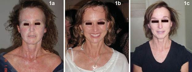 phương pháp Dr. Michaels ảnh 2 phuong phap Dr. Michaels anh 2