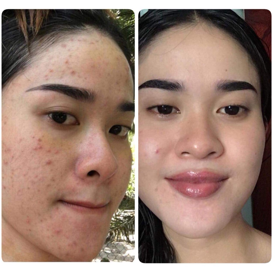 My pham Thanh Duoc anh 3