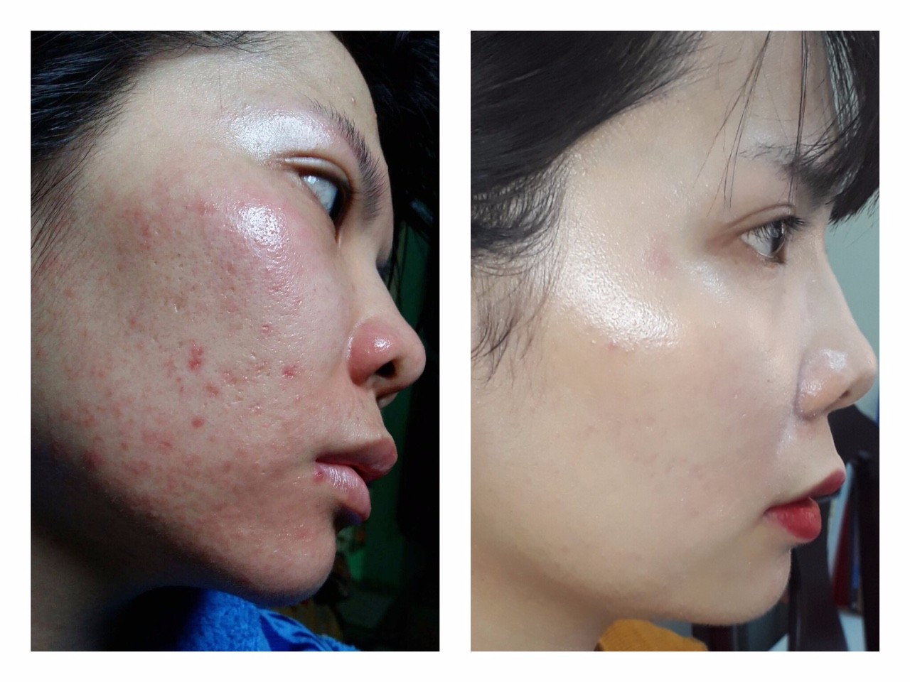 My pham Thanh Duoc anh 4