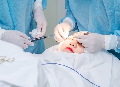 3 giai phap tham my cho doi mat dep hinh anh