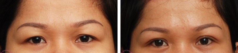 Trung tâm thẩm mỹ Xuân Hùng ảnh 2 Trung tam tham my Xuan Hung anh 2