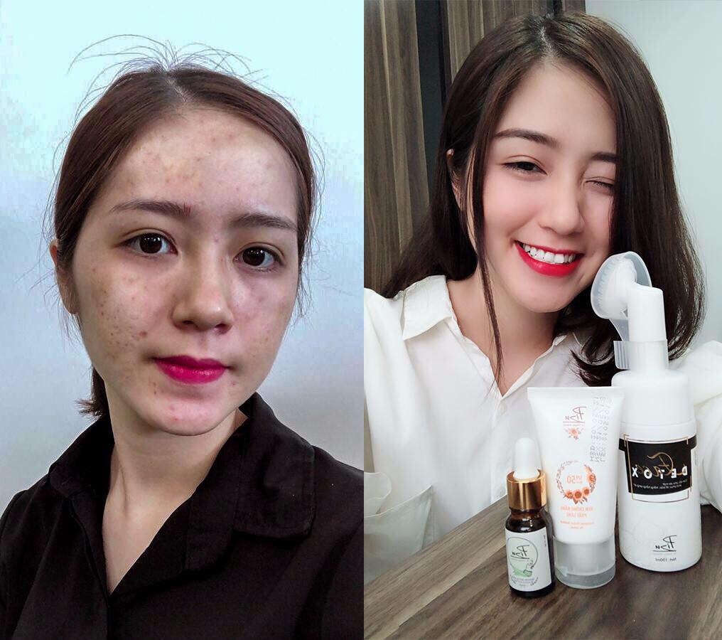 Face Detox anh 4