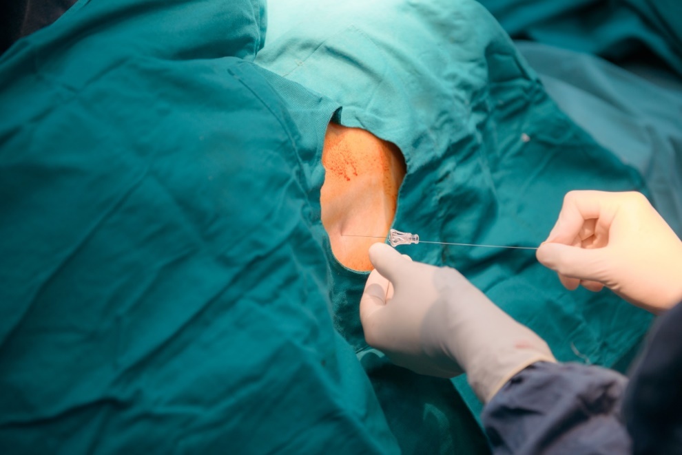 Benh vien DKQT Thu Cuc anh 3