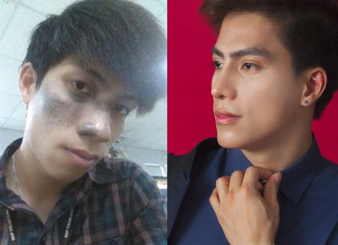 Tham my vien Dong A anh 1