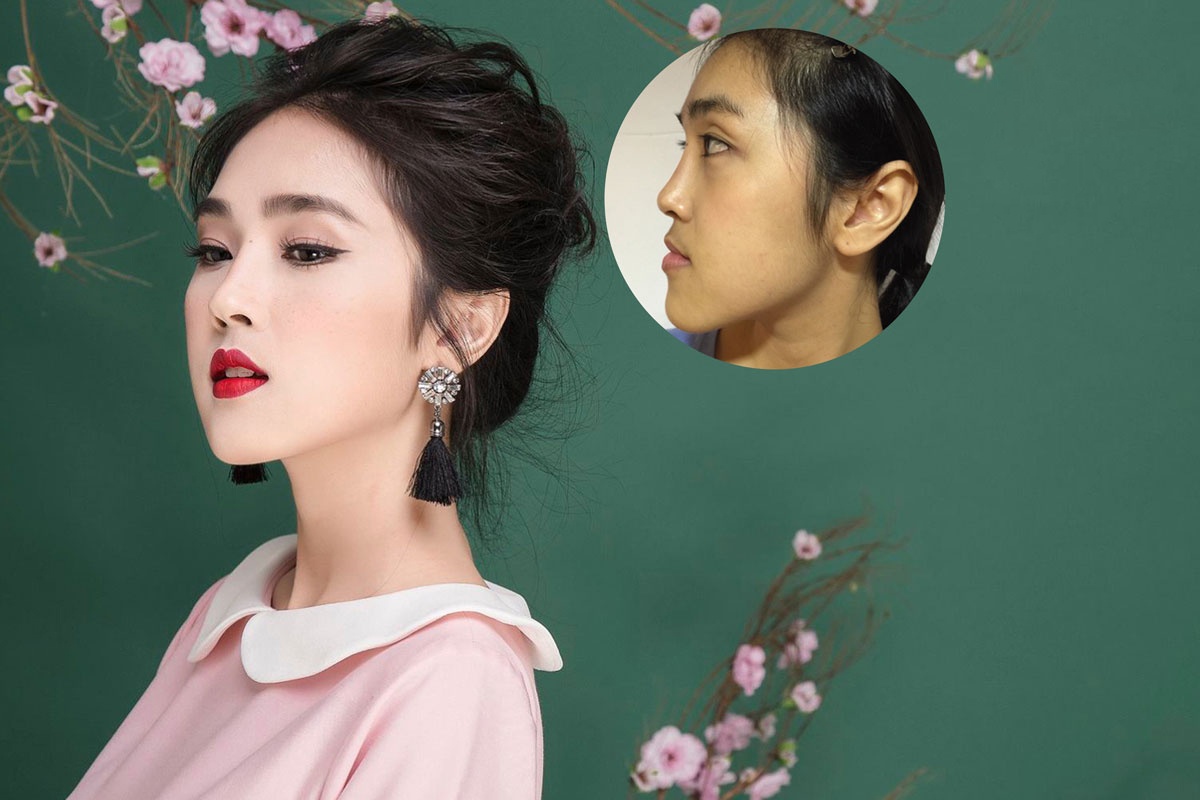 Bệnh viện Thẩm mỹ Ngọc Phú ảnh 3 Benh vien Tham my Ngoc Phu anh 3