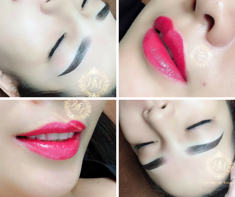 Thẩm mỹ Hương Mi ảnh 3 Tham my Huong Mi anh 3