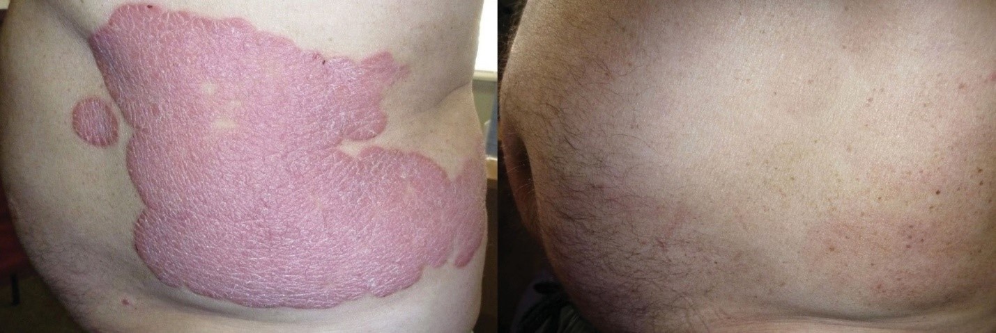 Phương pháp Dr. Michaels ảnh 2 Phuong phap Dr. Michaels anh 2