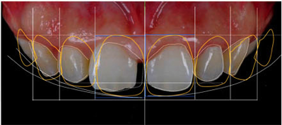 nha khoa Kim ảnh 4 nha khoa Kim anh 4
