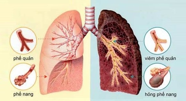 keo ong ảnh 1 keo ong anh 1