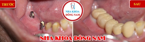 Nha khoa Dong Nam anh 4