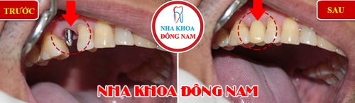 Nha khoa Dong Nam anh 5