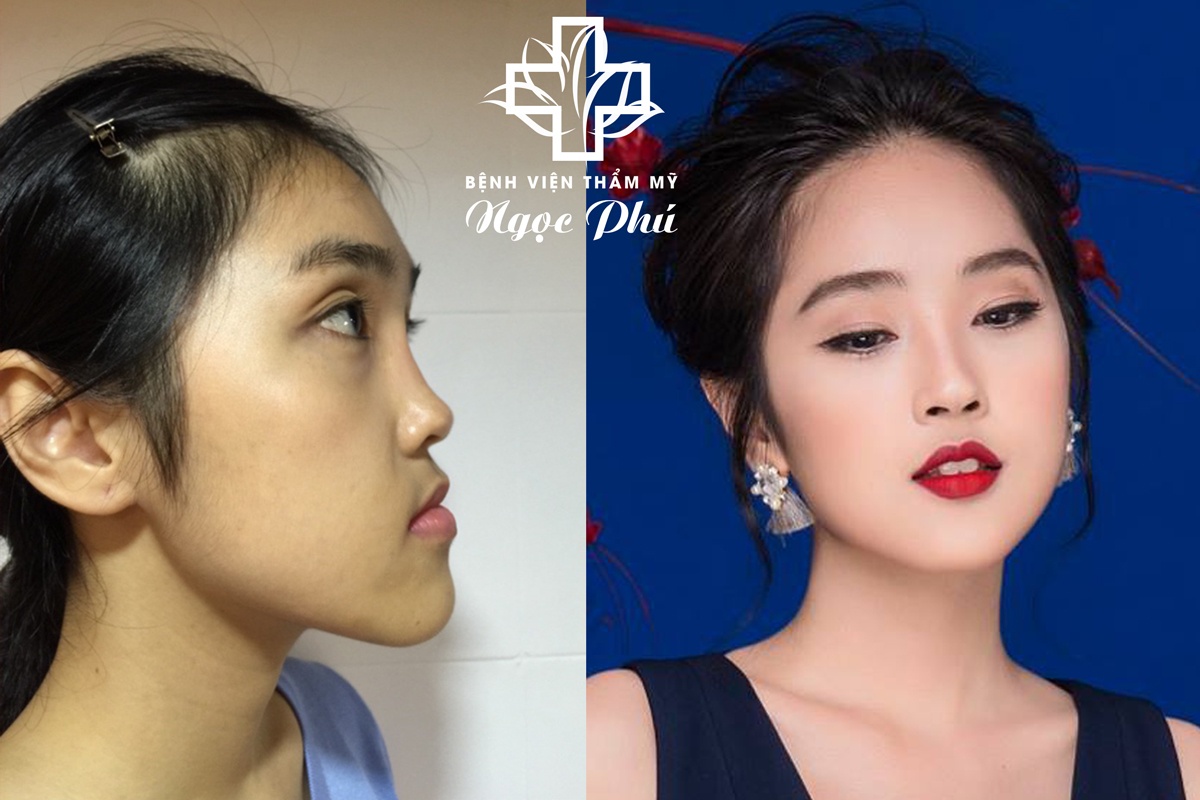 bệnh viện thẩm mỹ Ngọc Phú ảnh 3 benh vien tham my Ngoc Phu anh 3