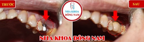 Nha khoa Dong Nam anh 4