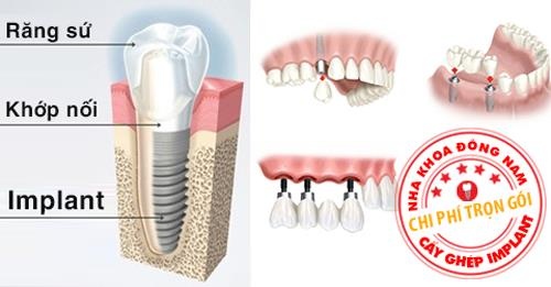 Nha khoa Dong Nam anh 4