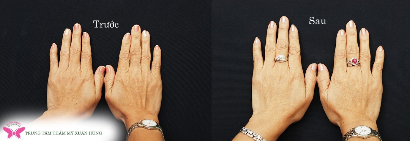 Trung tam tham my Xuan Hung anh 3