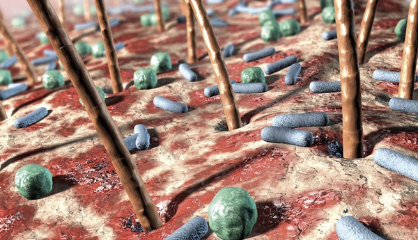 Pond's ảnh 1 Pond's anh 1