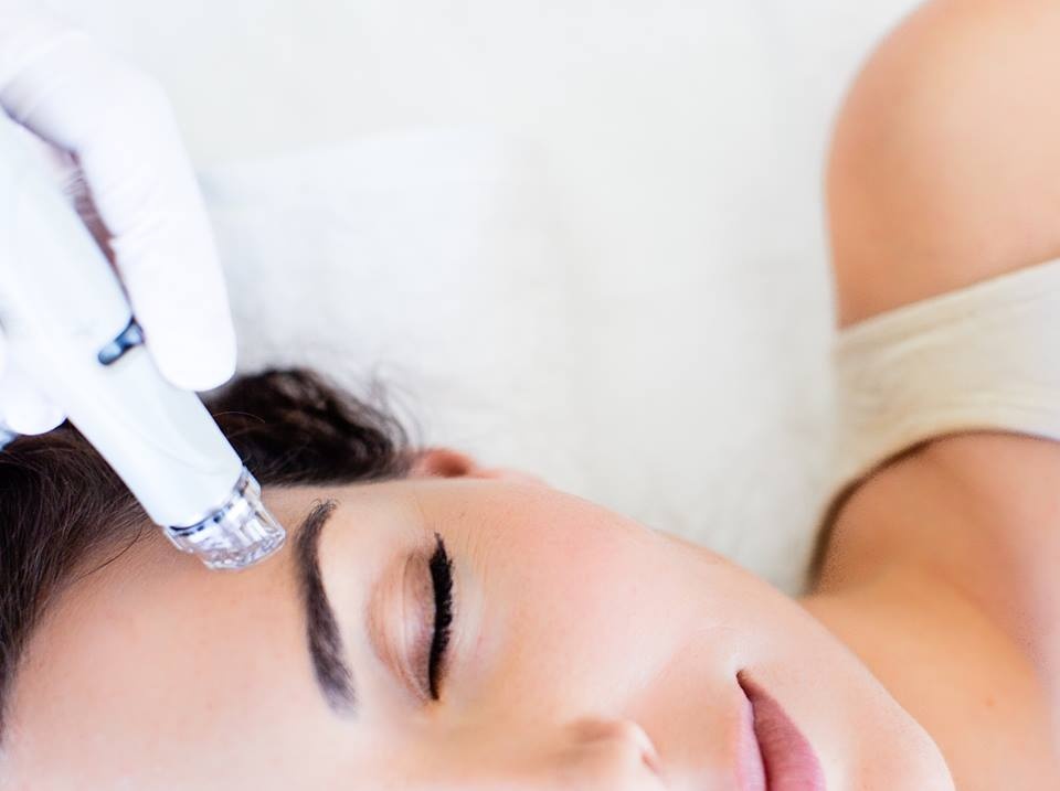 HydraFacial - lieu trinh lam dep nhanh, gon cua cac co dau hinh anh