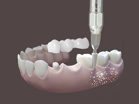nha khoa Dr Care ảnh 1 nha khoa Dr Care anh 1