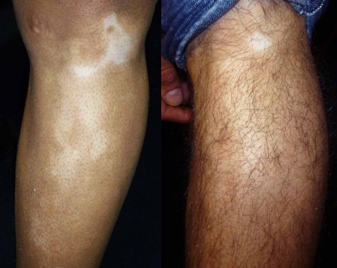 Dr Michaels ảnh 2 Dr Michaels anh 2