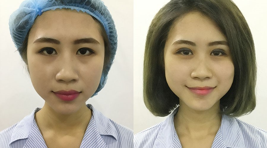 Viện thẩm mỹ y khoa Dr.Hải Lê ảnh 2 Vien tham my y khoa Dr.Hai Le anh 2