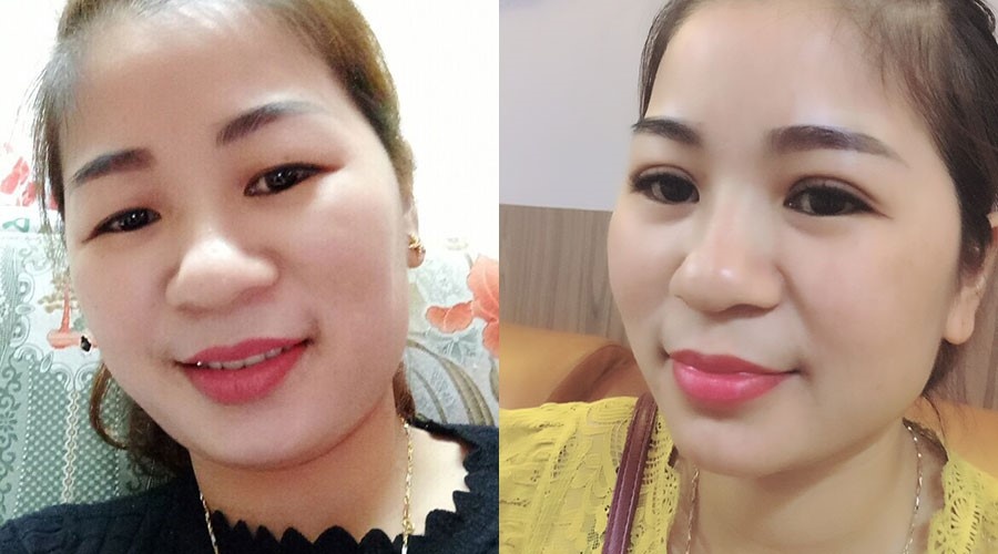 Viện thẩm mỹ y khoa Dr.Hải Lê ảnh 3 Vien tham my y khoa Dr.Hai Le anh 3