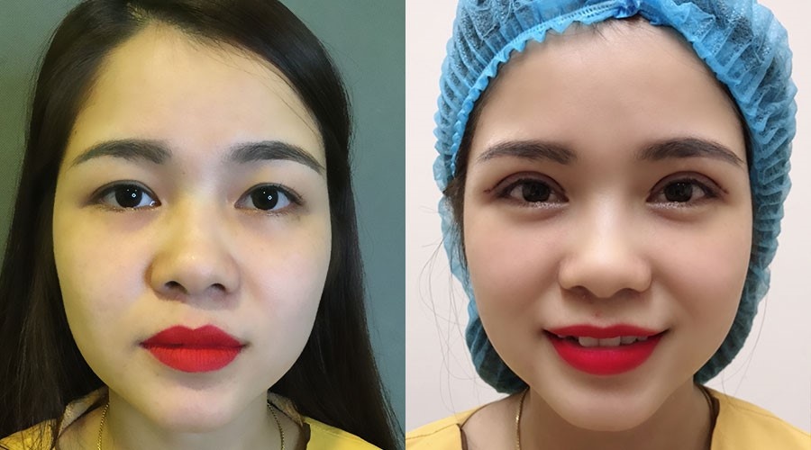Viện thẩm mỹ y khoa Dr.Hải Lê ảnh 4 Vien tham my y khoa Dr.Hai Le anh 4