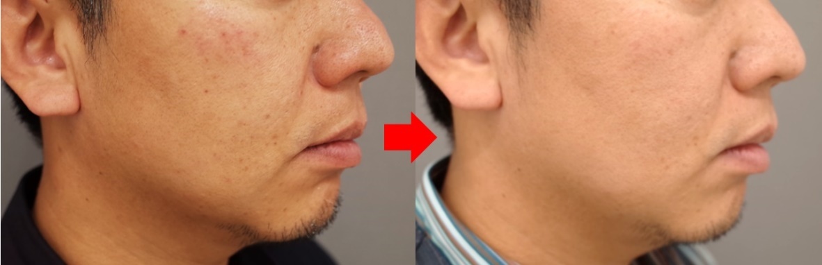 Bệnh viện Thẩm mỹ Việt Mỹ ảnh 2 Benh vien Tham my Viet My anh 2