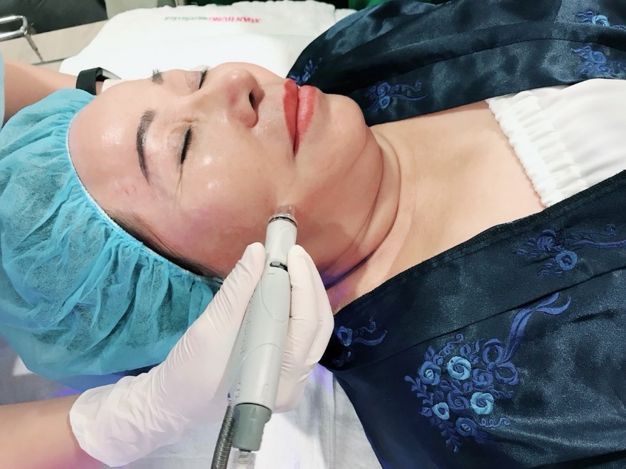 tham my Xuan Hung anh 3