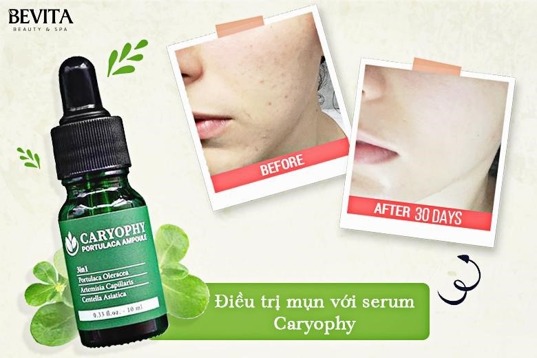 Bevita Beauty & Spa ảnh 2 Bevita Beauty & Spa anh 2