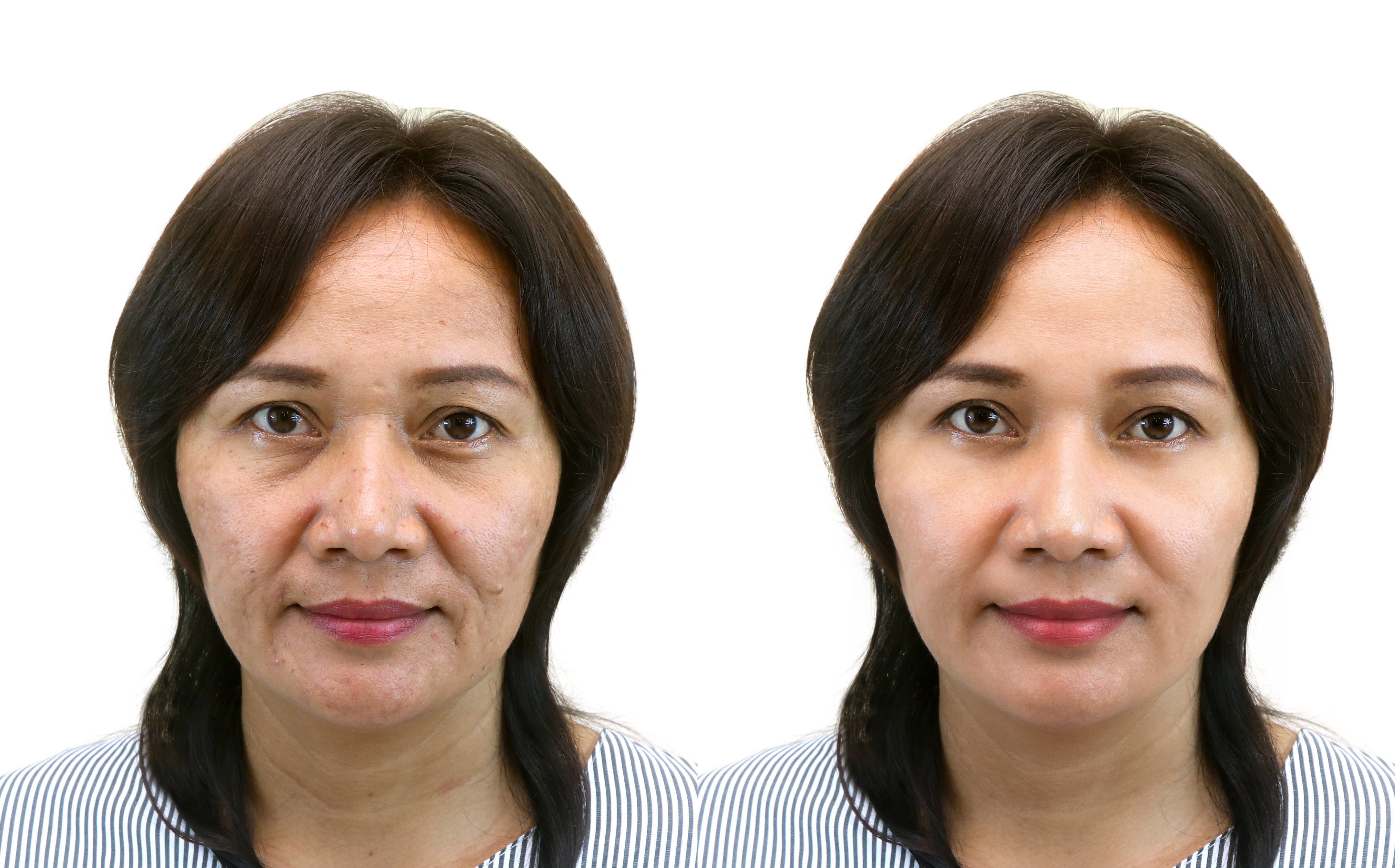 Benh vien tham my Ngoc Phu anh 3