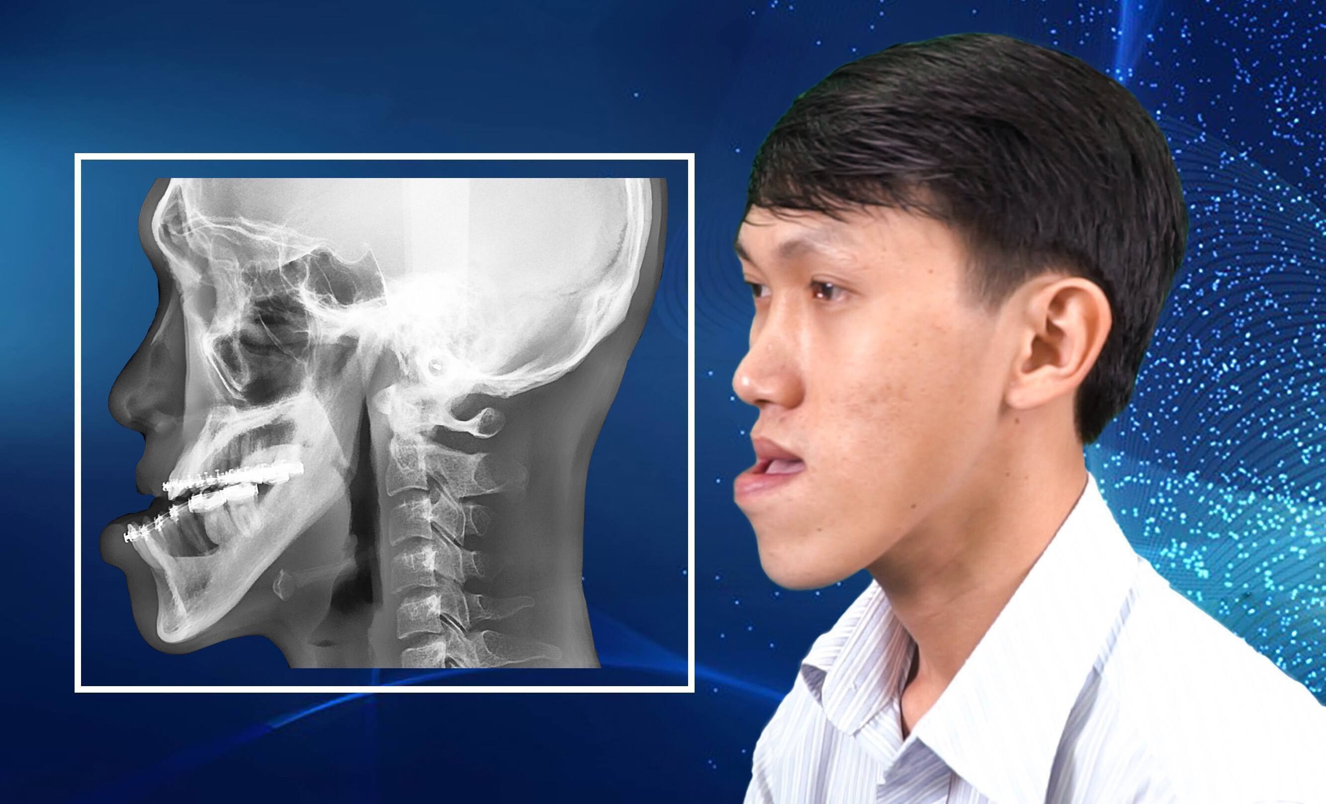 Bệnh viện thẩm mỹ JW Hàn Quốc ảnh 1 Benh vien tham my JW Han Quoc anh 1