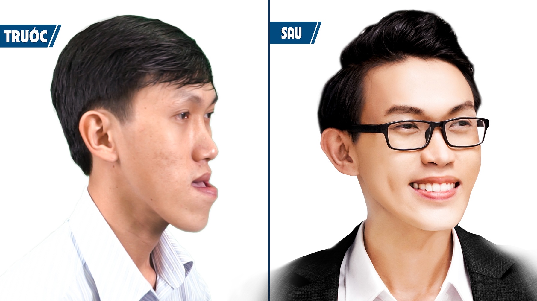 Bệnh viện thẩm mỹ JW Hàn Quốc ảnh 4 Benh vien tham my JW Han Quoc anh 4