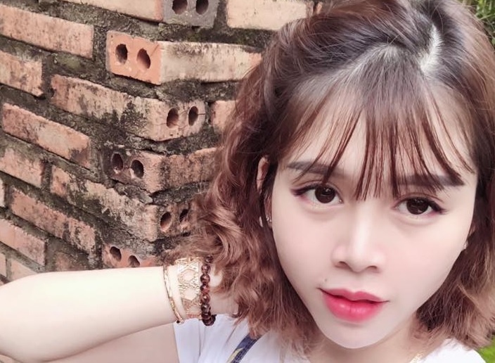 Nhung nguoi tre 'lot xac' thanh cong sau phau thuat chinh ham hinh anh