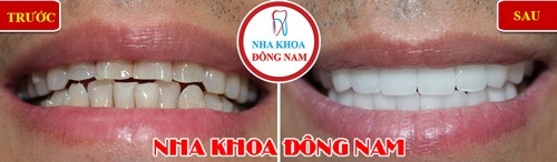 Nha khoa Dong Nam anh 4