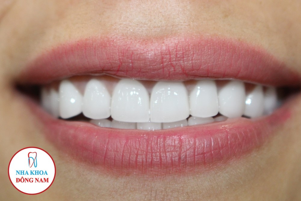 Nha khoa Dong Nam anh 5