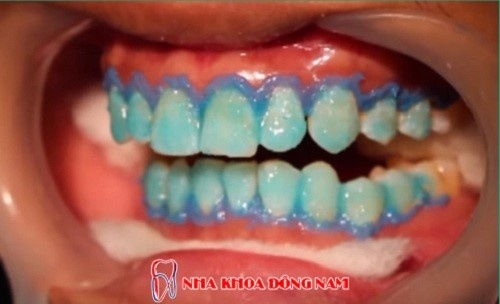 Nha khoa Đông Nam ảnh 3 Nha khoa Dong Nam anh 3