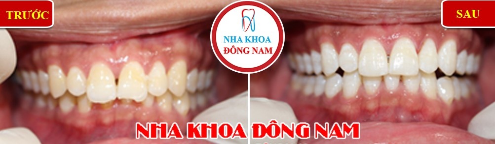 Nha khoa Đông Nam ảnh 4 Nha khoa Dong Nam anh 4