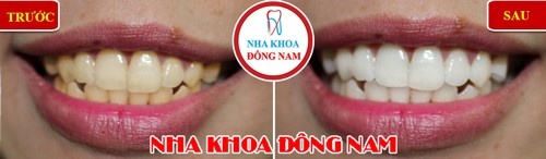 Nha khoa Đông Nam ảnh 5 Nha khoa Dong Nam anh 5