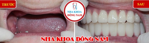 Nha khoa Dong Nam anh 2