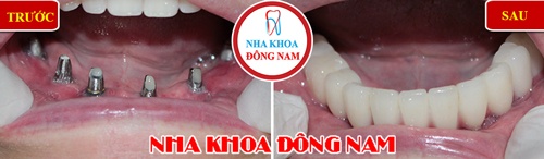 Nha khoa Dong Nam anh 4