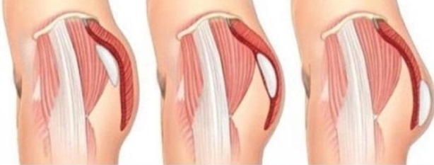 Bệnh viện thẩm mỹ JW ảnh 2 Benh vien tham my JW anh 2