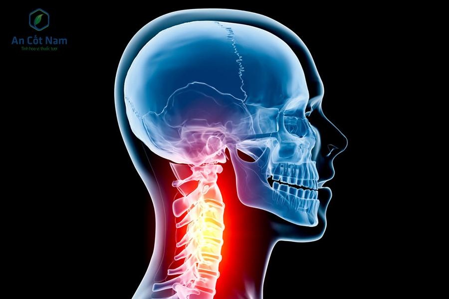 phac do An Cot Nam anh 1