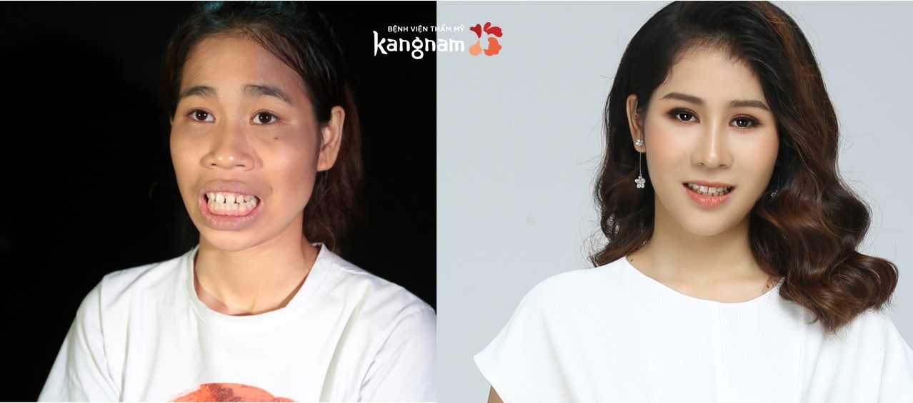 Hành trình lột xác ảnh 1 Hanh trinh lot xac anh 1