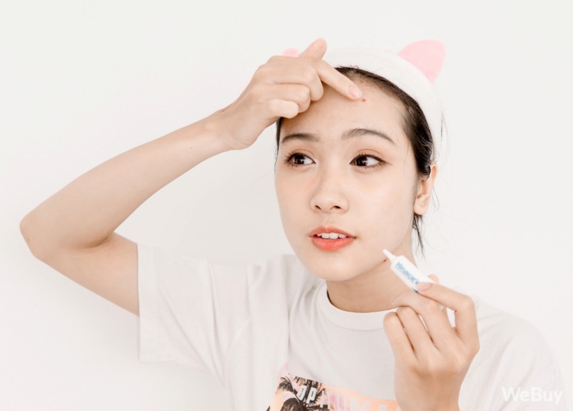 Hiruscar ảnh 5 Hiruscar anh 5