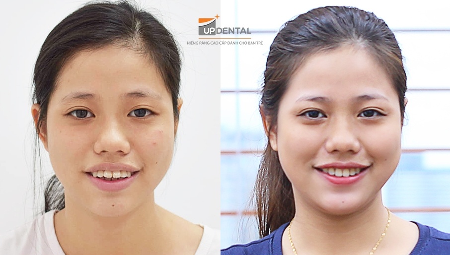 Up Dental anh 3
