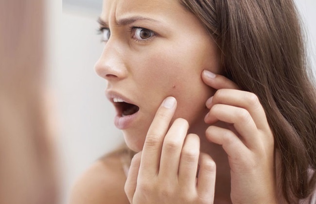 Giai phap dieu tri mun tu goc hinh anh