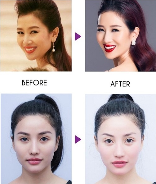 Thea ảnh 3 Thea anh 3