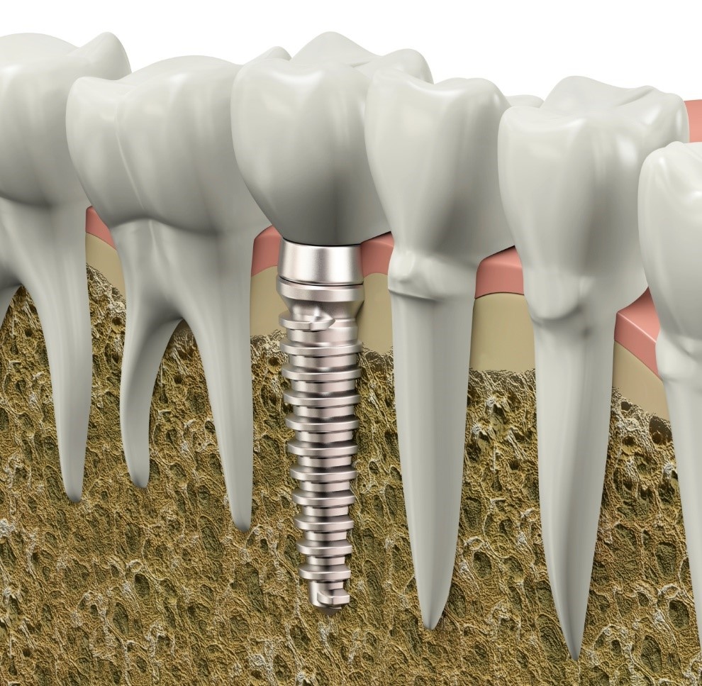 Peace Dentistry ảnh 1 Peace Dentistry anh 1