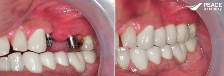 Peace Dentistry ảnh 2 Peace Dentistry anh 2